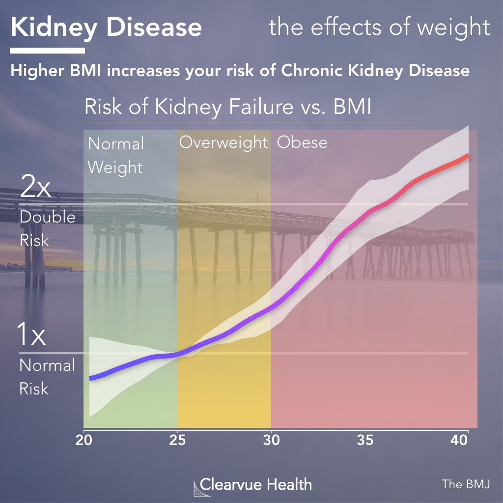 chart of bmi and chronic kidney disease