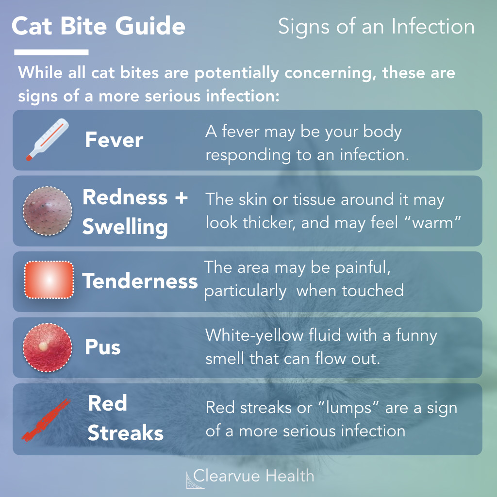 3 Charts Cat Bite Guide Symptoms And First Aid